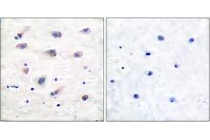 Immunohistochemistry analysis of paraffin-embedded human brain, using PLCB3 (Phospho-Ser1105) Antibody. (PLCB3 抗体  (pSer1105))