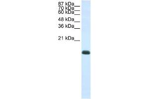 WB Suggested Anti-ZNF786 Antibody Titration:  1. (ZNF786 抗体  (N-Term))