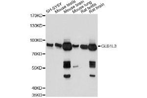 Western blot analysis of extracts of various cell lines, using GLB1L3 antibody. (GLB1L3 抗体)