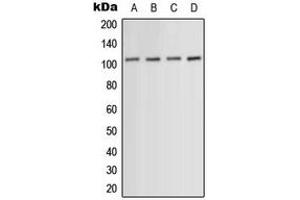 Western blot analysis of ACTN1/2/3/4 expression in HeLa (A), HuvEc (B), mouse muscle (C), PC12 (D) whole cell lysates.
