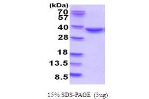 SDS-PAGE (SDS) image for TatD DNase Domain Containing 1 (TATDN1) (AA 1-297) protein (His tag) (ABIN5778876) (TATDN1 Protein (AA 1-297) (His tag))