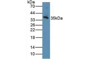 Detection of CD1d in Human K562 Cells using Polyclonal Antibody to Cluster Of Differentiation 1d (CD1d) (CD1d 抗体  (AA 56-271))