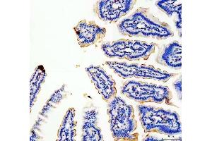 IHC analysis of MUC13 using anti-MUC13 antibody (ABIN6719597). (MUC13 抗体  (AA 226-312))