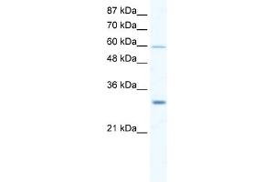 WB Suggested Anti-DDX31 Antibody Titration:  2. (DDX31 抗体  (N-Term))