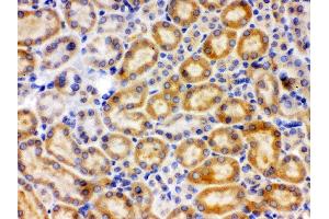 Anti-CYP27B1 Picoband antibody, IHC(P) IHC(P): Rat Kidney Tissue (CYP27B1 抗体  (C-Term))