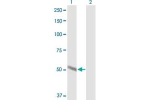 Western Blotting (WB) image for anti-Cytochrome P450, Family 2, Subfamily A, Polypeptide 6 (CYP2A6) (AA 1-494) antibody (ABIN514822)