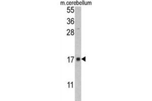 Western Blotting (WB) image for anti-FK506 Binding Protein 2, 13kDa (FKBP2) antibody (ABIN3002777) (FKBP2 抗体)