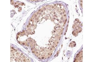 ABIN6267381 at 1/200 staining human testis tissue sections by IHC-P. (BRAF 抗体  (pThr599))