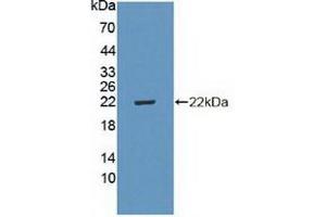 Figure. (CDKN2D 抗体  (AA 1-166))