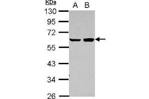 WB Image Sample (30 ug of whole cell lysate) A: A431 B: HeLa 10% SDS PAGE antibody diluted at 1:1000 (PDCD4 抗体)