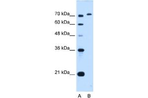 WB Suggested Anti-GPAA1 Antibody Titration:  0. (GPAA1 抗体  (C-Term))