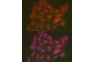 Immunofluorescence analysis of U2OS cells using LML Rabbit pAb (ABIN7268204) at dilution of 1:250 (40x lens). (LMAN2L 抗体)