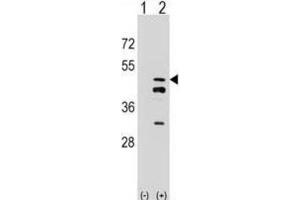 Western Blotting (WB) image for anti-Farnesyl Diphosphate Synthase (FDPS) antibody (ABIN2998304) (FDPS 抗体)