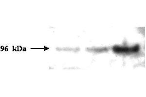 Western blot analysis is shown using  Protein A Purified Mouse Monoclonal Anti-PMS2 antibody to detect human PMS2 protein present in H157 cell lysates. (PMS2 抗体)