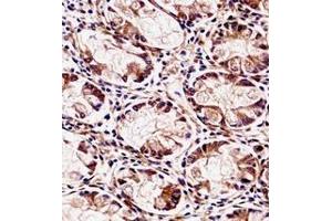 Immunohistochemistry (Paraffin-embedded Sections) (IHC (p)) image for anti-FXYD Domain Containing Ion Transport Regulator 5 (FXYD5) (AA 70-100), (Middle Region) antibody (ABIN952009)