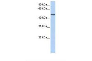 Image no. 1 for anti-Pleckstrin Homology-Like Domain, Family A, Member 1 (PHLDA1) (AA 290-339) antibody (ABIN6739003)