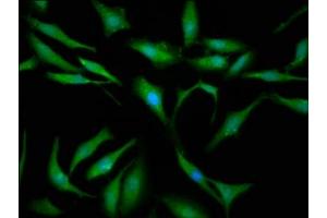 Immunofluorescence staining of Hela cells with ABIN7168210 at 1:133, counter-stained with DAPI. (SBDS 抗体  (AA 37-153))