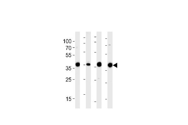 Aldolase 抗体  (N-Term)