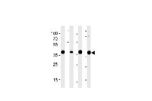 Western blot analysis of lysates from 293,RD,mouse NIH/3T3,rat L6 cell line (from left to right),using ALDOA Antibody at 1:1000 at each lane. (Aldolase 抗体  (N-Term))