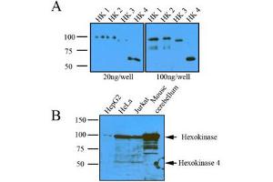 Western Blotting (WB) image for anti-Hexokinase 1 (HK1) (AA 1-917), (N-Term) antibody (ABIN317095)
