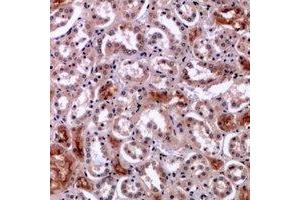 Immunohistochemical analysis of Perforin 1 staining in human kidney formalin fixed paraffin embedded tissue section. (Perforin 1 抗体  (C-Term))