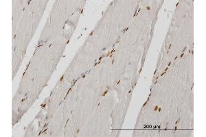 Immunoperoxidase of monoclonal antibody to HIRIP3 on formalin-fixed paraffin-embedded human skeletal muscle. (HIRIP3 抗体  (AA 447-555))