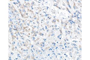 Immunohistochemistry (IHC) image for anti-Transforming Growth Factor, beta 1 (TGFB1) (AA 325-375) antibody (ABIN7449529) (Recombinant TGFB1 抗体  (AA 325-375))