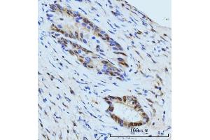 IHC analysis of SBNO1 using anti-SBNO1 antibody (ABIN7601710). (SBNO1 抗体  (AA 43-1303))