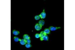 ICC/IF analysis of IRF5 in THP-1 cells line, stained with DAPI (Blue) for nucleus staining and monoclonal anti-human THP-1 antibody (1:100) with goat anti-mouse IgG-Alexa fluor 488 conjugate (Green). (IRF5 抗体)