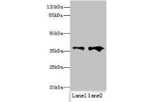 Western blot All lanes: RPRD1B antibody at 0.