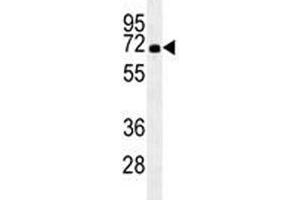 Western Blotting (WB) image for anti-Heat Shock 70kDa Protein 1A (HSPA1A) (AA 574-600) antibody (ABIN3031153)