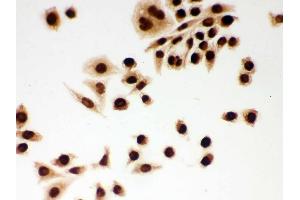 IHC analysis of DDB1 using anti-DDB1 antibody .
