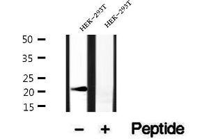 Western blot analysis of extracts of HEK-293T cells, using BBS3 antibody.