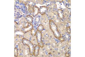 Immunohistochemistry of paraffin-embedded rat kidney using MMP14 antibody. (MMP14 抗体)