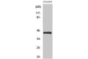 Western Blotting (WB) image for anti-Tumor Suppressor Candidate 3 (TUSC3) (Internal Region) antibody (ABIN3176197) (TUSC3 抗体  (Internal Region))