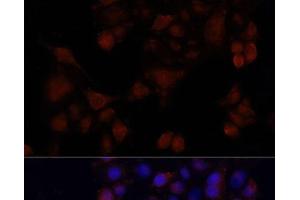 Immunofluorescence analysis of HeLa cells using MAPRE1 Polyclonal Antibody at dilution of 1:100. (MAPRE1 抗体)