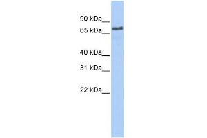 WB Suggested Anti-MARCH7 Antibody Titration:  0. (MARCH7 抗体  (Middle Region))
