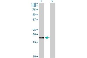 Western Blot analysis of BIRC5 expression in transfected 293T cell line by BIRC5 monoclonal antibody (M01), clone 5B10. (Survivin 抗体  (AA 1-100))