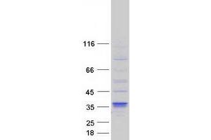 Western Blotting (WB) image for Dehydrogenase/reductase (SDR Family) Member 7B (DHRS7B) protein (Myc-DYKDDDDK Tag) (ABIN2719452)