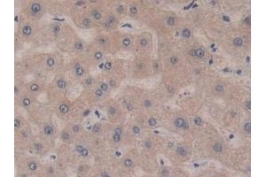 Detection of BCAS3 in Human Liver Tissue using Polyclonal Antibody to Breast Carcinoma Amplified Sequence 3 (BCAS3) (BCAS3 抗体  (AA 230-546))
