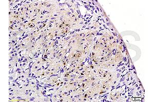 Formalin-fixed and paraffin embedded rat uterine myoma labeled with Rabbit Anti-ER-beta Polyclonal Antibody (ABIN725735) at 1:200 followed by conjugation to the secondary antibody and DAB staining. (TACR3 抗体  (AA 151-250))
