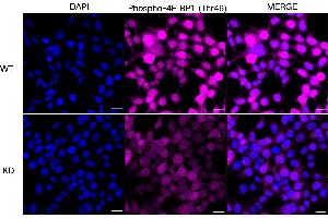 anti-Eukaryotic Translation Initiation Factor 4E Binding Protein 1 (EIF4EBP1) (pThr46) antibody