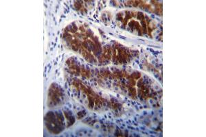 FRK Antibody (N-term) (ABIN392097 and ABIN2841849) immunohistochemistry analysis in formalin fixed and paraffin embedded human stomach tissue followed by peroxidase conjugation of the secondary antibody and DAB staining.