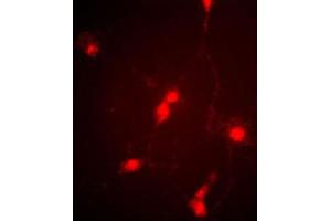 Immunofluorescence (IF) image for anti-Chloride Channel 4 (CLCN4) antibody (ABIN3002620) (CLCN4 抗体)