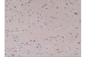 IHC-P analysis of Human Brain Tissue, with DAB staining. (TLR9 抗体  (AA 28-362))