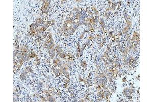 IHC analysis of Neurofibromin/NF1 using anti-Neurofibromin/NF1 antibody (ABIN7600197). (Neurofibromin 1 抗体  (AA 160-270))