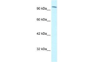 WB Suggested Anti-SMARCC1 Antibody Titration: 1. (SMARCC1 抗体  (C-Term))
