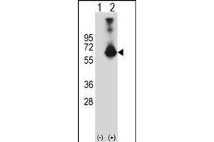 Western blot analysis of CBS (arrow) using rabbit polyclonal CBS Antibody (N-term) (ABIN1881141 and ABIN2841140). (CBS 抗体  (N-Term))