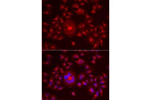 Immunofluorescence analysis of A549 cells using GORASP1 antibody (ABIN5973972). (GORASP1 抗体)