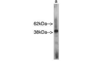 Image no. 1 for anti-Sterile alpha Motif Domain Containing 8 (SAMD8) antibody (ABIN793629) (SAMD8 抗体)